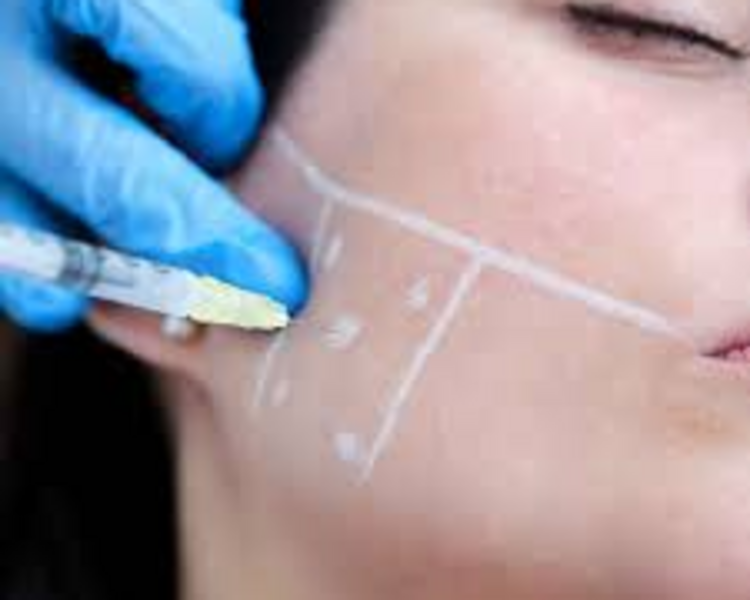 BRUXISMO - Botox