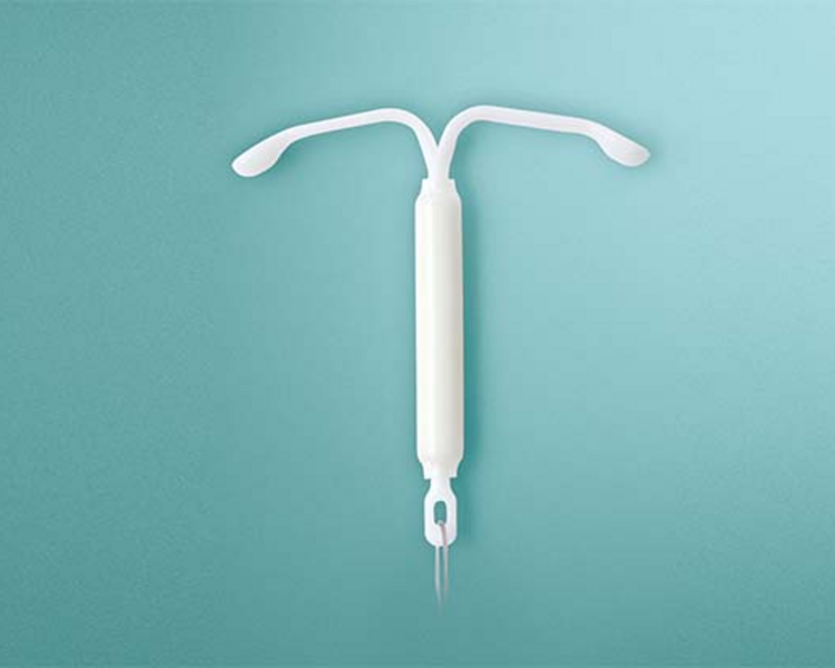 Inserción DIU hormonal (c/dispositivo)