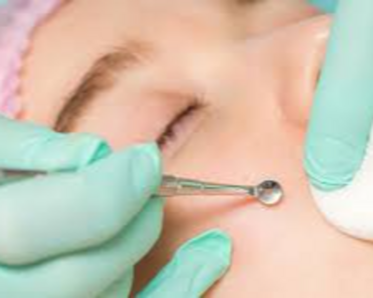 LIMPIEZA FACIAL PROFUNDA