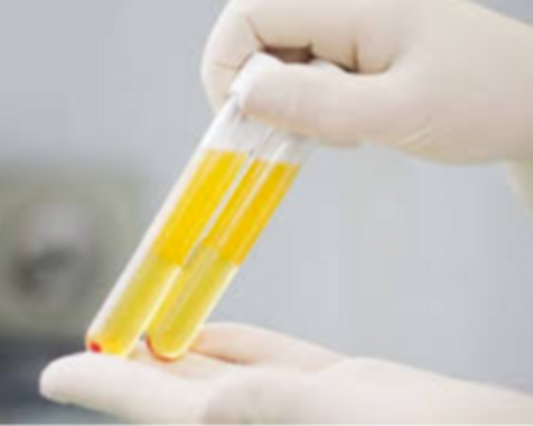 PRP VAGINAL