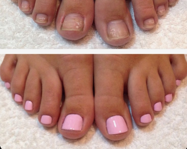 Pedicure