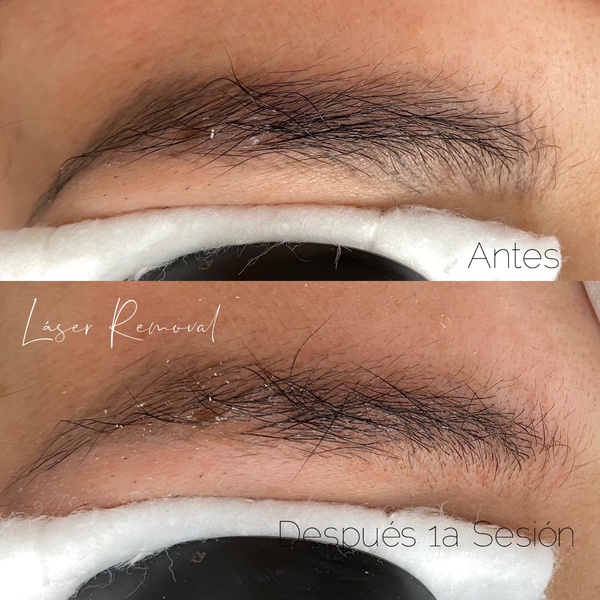 Valoración de procedimiento microblading