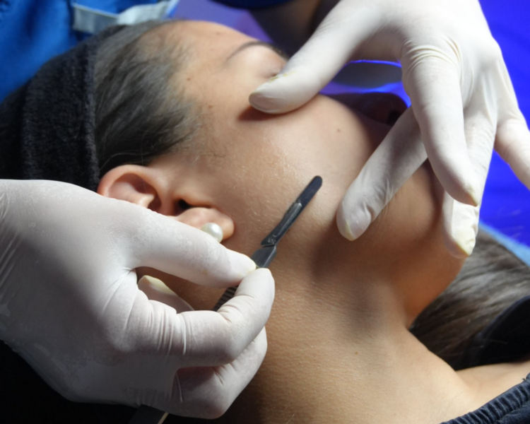 Higiene Facial c/ Dermaplaning  - 1 sesión