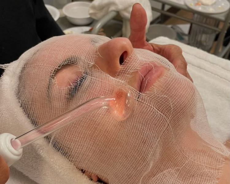 Rejuvenecimiento facial con dermapen