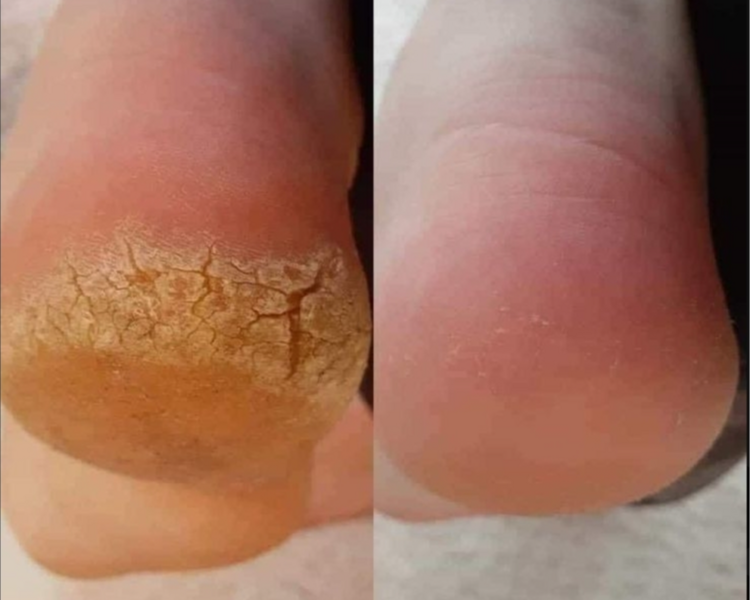 Podología + pedicure permanente 🎁 baño de parafina