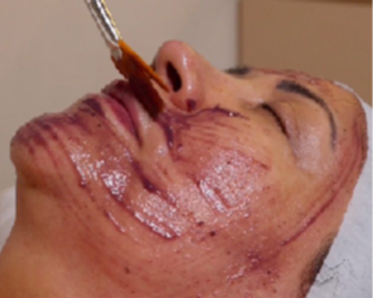 Facial Personalizado