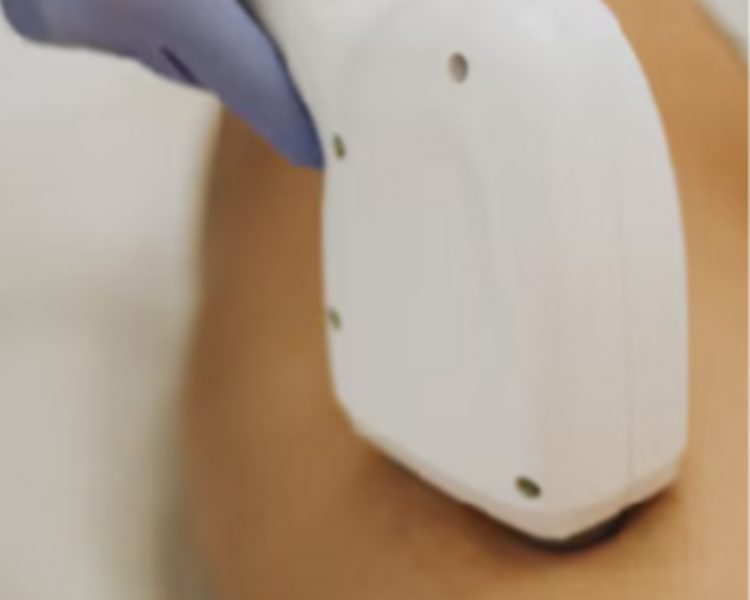 Gluteos e Intergluteo