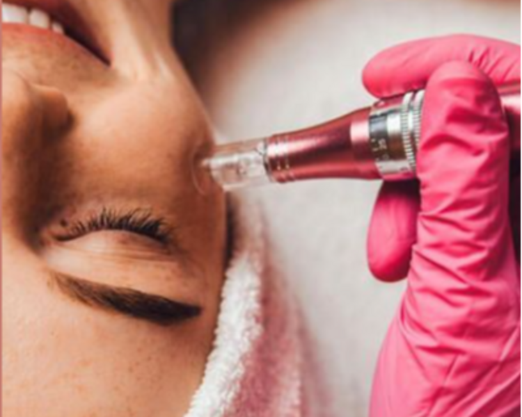 Rejuvenece y Revitaliza tu Piel /Microneedling con Dermapen. 