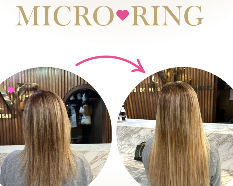 Aplicación de Micro Ring 1x1 (1/2 paquete) 