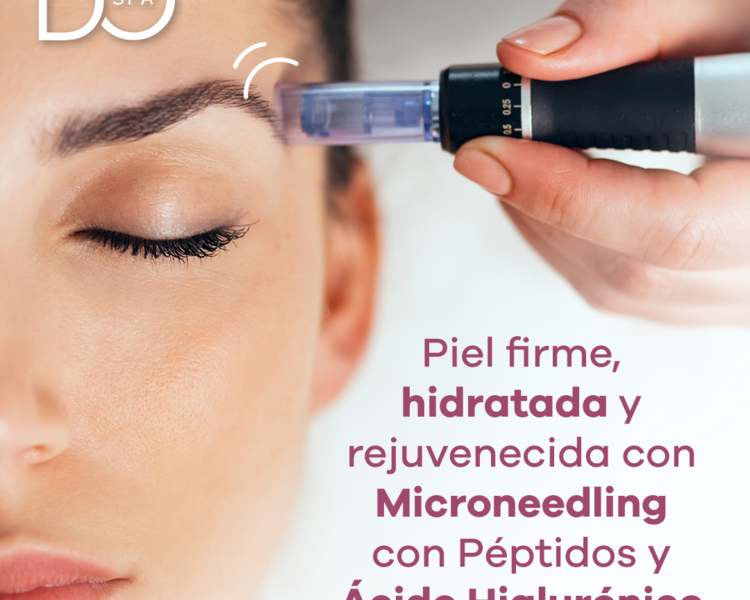 Microneedling con Péptidos + AH