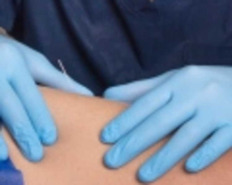 Fisioterapia Subsecuente