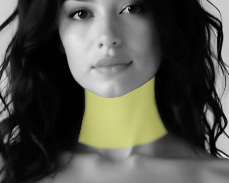 Depilación láser cuello anterior mujer (6 sesiones + 2 sesiones GRATIS)
