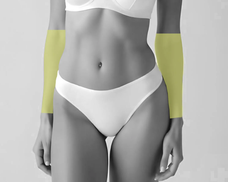 Depilación láser antebrazos mujer (6 sesiones + 2 sesiones GRATIS)