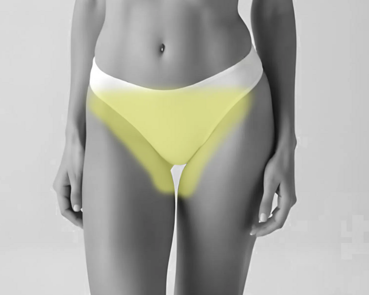 Depilación láser rebaje total mujer (6 sesiones + 2 sesiones GRATIS)