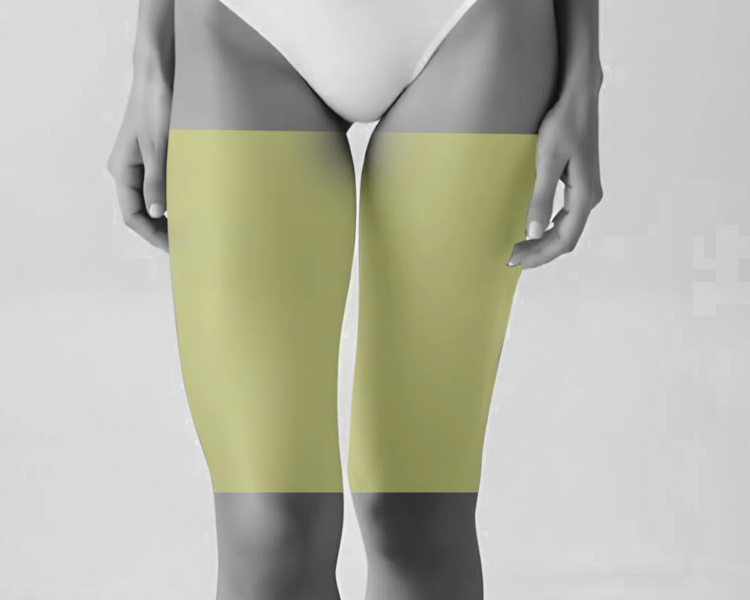 Depilación láser media pierna mujer (6 sesiones + 2 sesiones GRATIS)