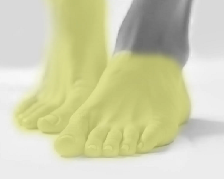 Depilación láser pie empeine y dedos de los pies mujer (6 sesiones + 2 sesiones GRATIS)