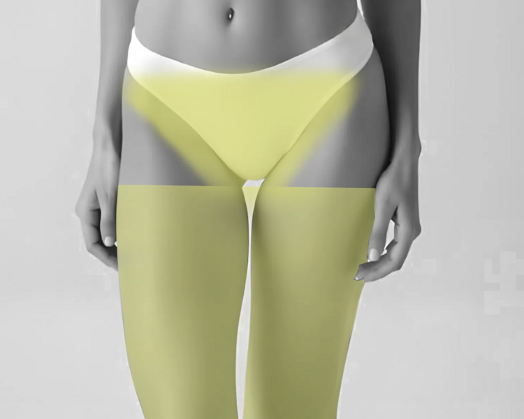 Pack: Depilación láser rebaje total + piernas completas mujer (6 sesiones + 2 sesiones GRATIS)