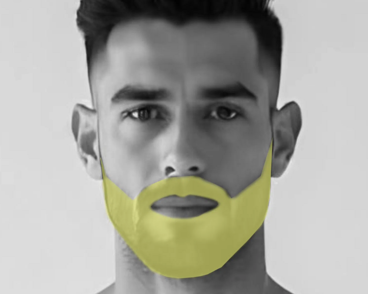 Depilación láser barba hombre (6 sesiones + 2 sesiones GRATIS)