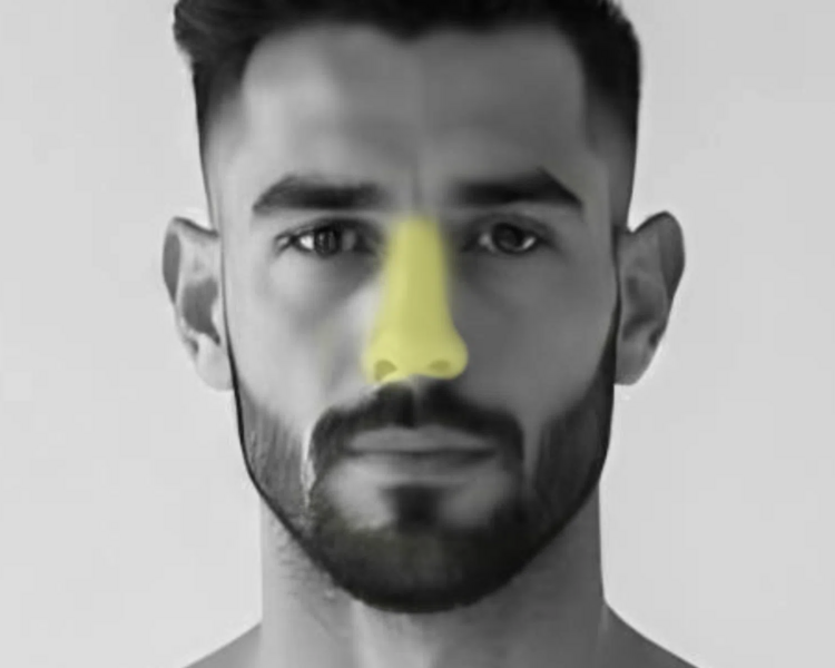 Depilación láser nariz hombre (6 sesiones + 2 sesiones GRATIS)
