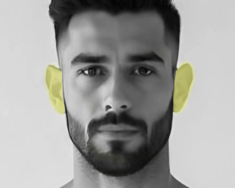 Depilación láser orejas hombre (6 sesiones + 2 sesiones GRATIS)