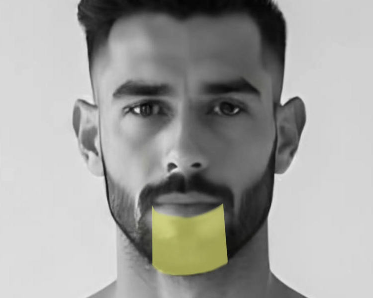 Depilación láser mentón hombre (6 sesiones + 2 sesiones GRATIS)