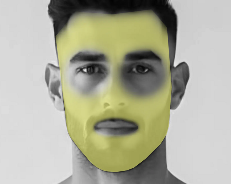 Depilación láser rostro completo hombre (6 sesiones + 2 sesiones GRATIS)