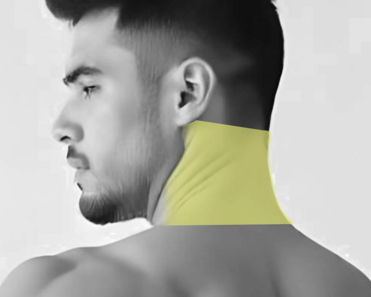 Depilación láser cuello posterior hombre (6 sesiones + 2 sesiones GRATIS)