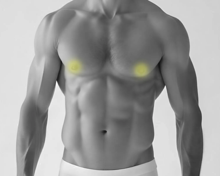 Depilación láser areolas hombre (6 sesiones + 2 sesiones GRATIS)