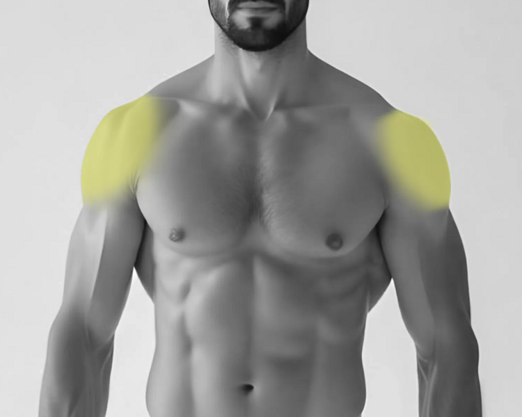 Depilación láser hombros hombre (6 sesiones + 2 sesiones GRATIS)