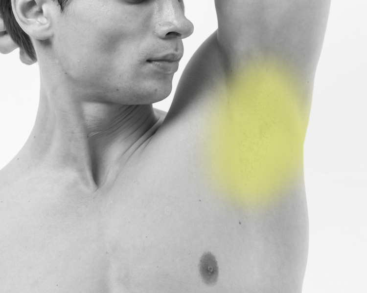 Depilación láser axilas hombre (6 sesiones + 2 sesiones GRATIS)