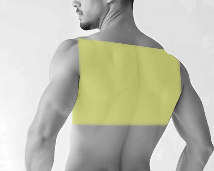 Depilación láser espalda superior hombre (6 sesiones + 2 sesiones GRATIS)