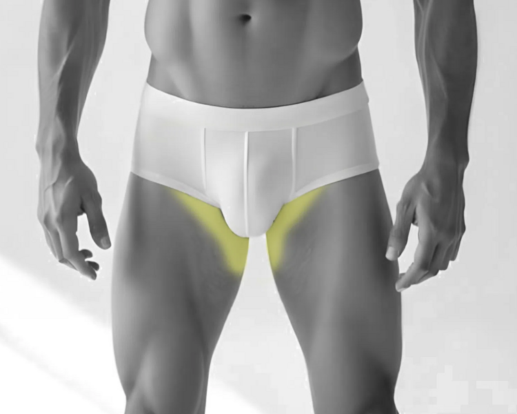 Depilación láser rebaje parcial hombre (6 sesiones + 2 sesiones GRATIS) 