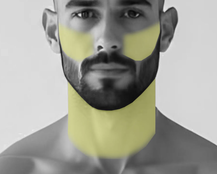 Pack: Depilación láser mejillas + cuello anterior hombre (6 sesiones + 2 sesiones GRATIS)