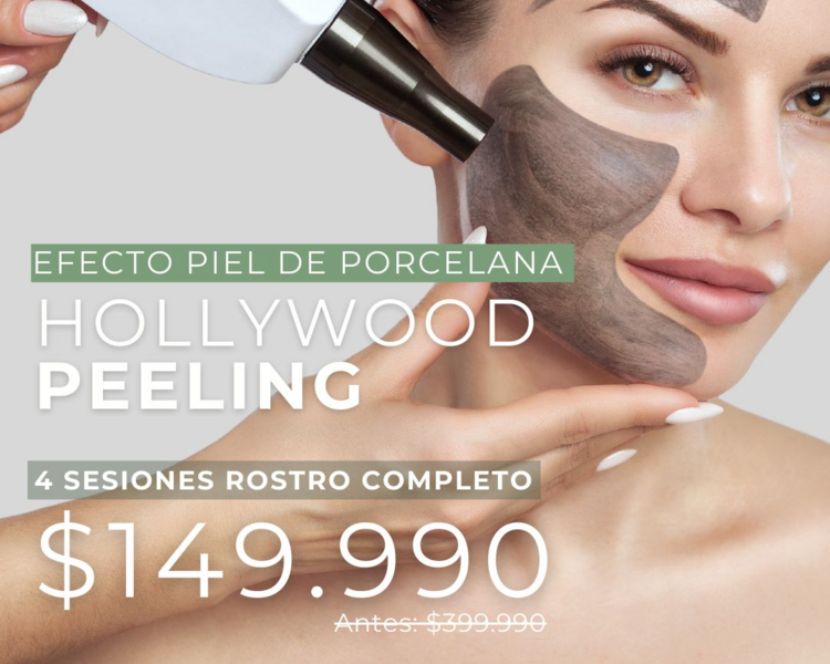 4 SESIONES HOLLYWOOD PEELING