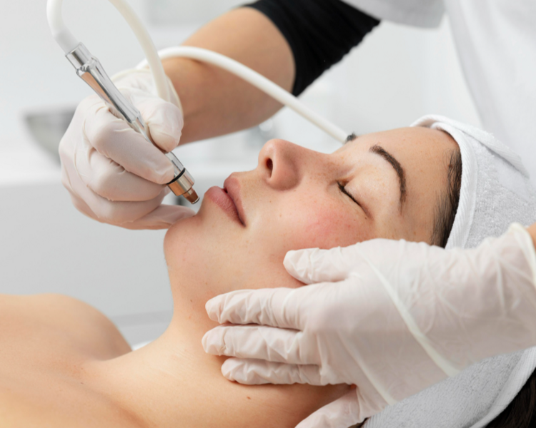 Microdermoabrasión facial (1 sesión)