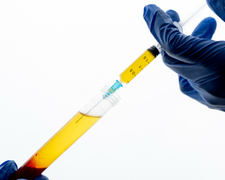 Rejuvenecimiento corporal con Plasma Rico en Plaquetas (3 sesiones)