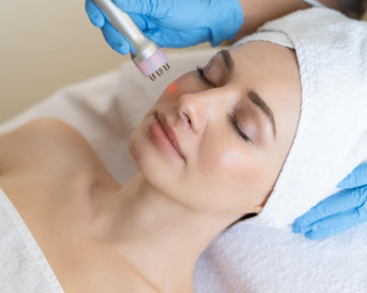 Radiofrecuencia facial (6 sesiones)