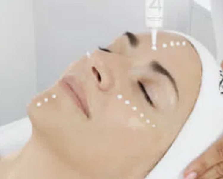Tratamiento regenerador /antiarrugas RGNERIN