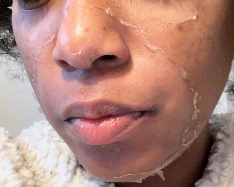 PEELING FACIAL