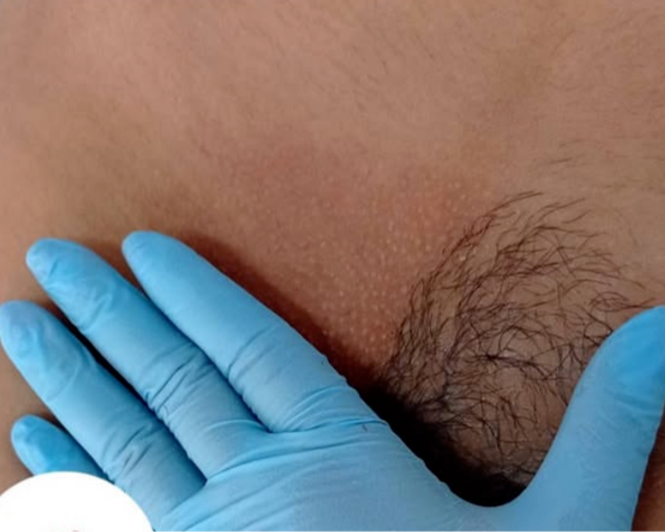 DEPILACION ZONA INTIMA MUJER BIKINI 