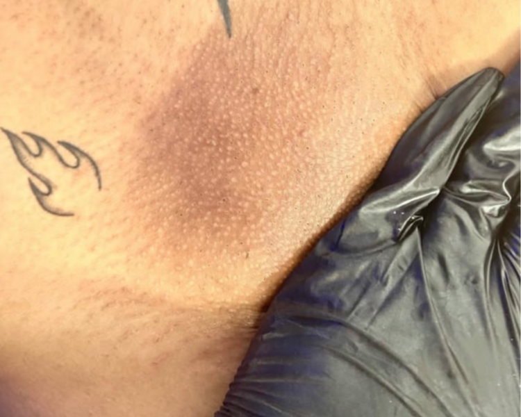 DEPILACION ZONA INTIMA MUJER BRASILEÑO