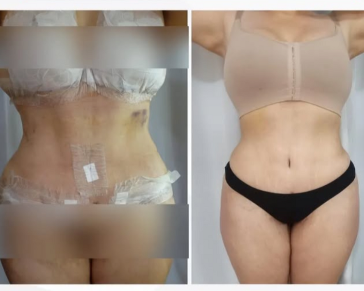 POST OPERATORIO PQ 5