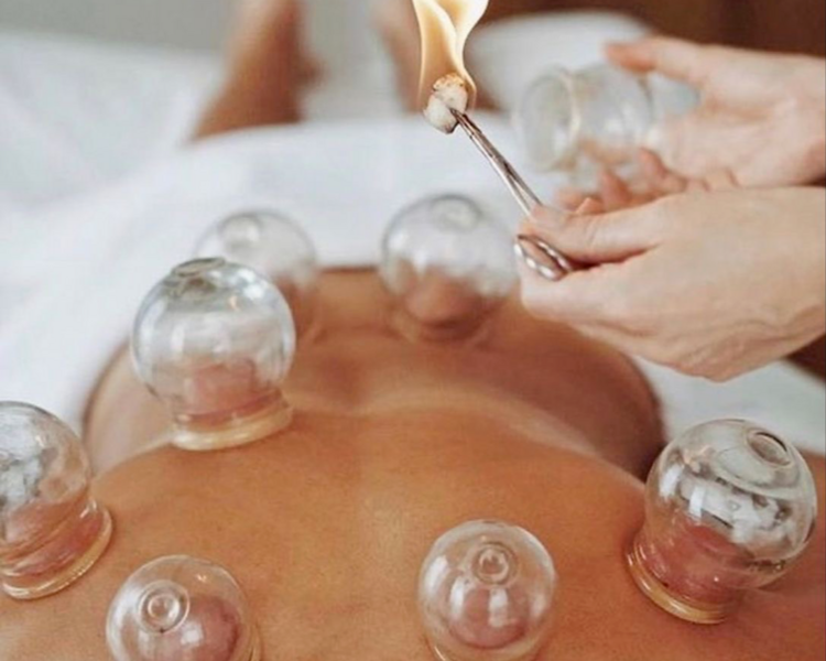 APLICACION DE VENTOSAS