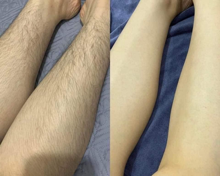 DEPILACION PIERNAS COMPLETAS