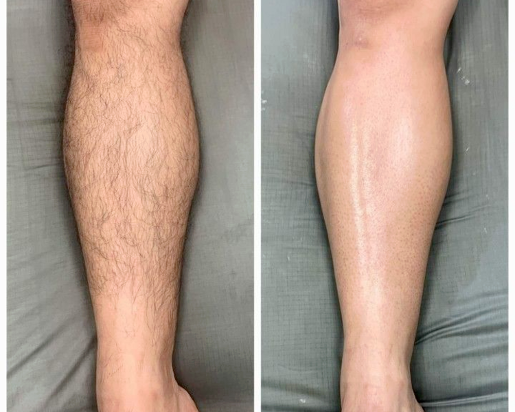 Cavado + Tira de cola + Pierna Entera (HOMBRE)