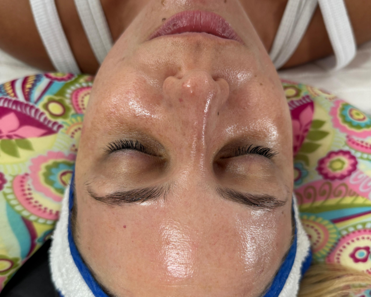 Limpieza glow con dermaplaning 