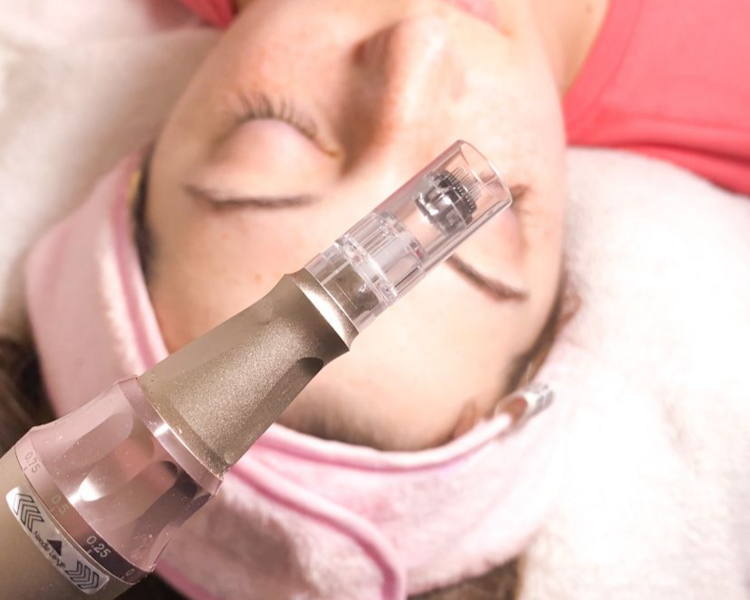 Dermapen facial