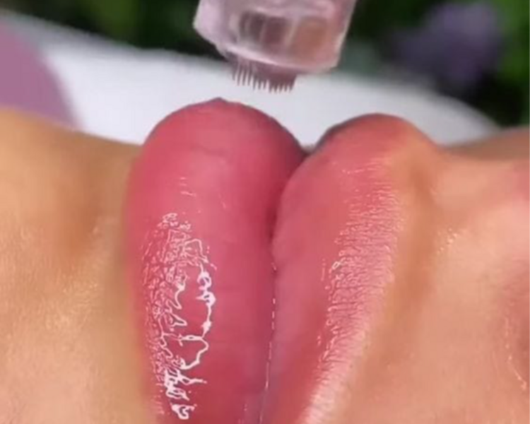 Dermapen hidralips