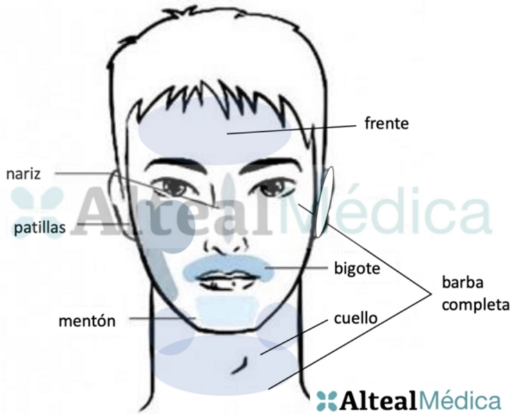PATILLAS (1 sesión) Depilación Láser Diodo