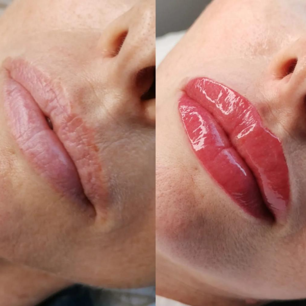 MICROPIGMENTACIÓN DE LABIOS